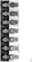 Fig. 09 - Normalization of facial images using deep neural networks