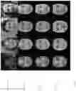 Fig. 10 - Normalization of facial images using deep neural networks