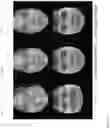 Fig. 12 - Normalization of facial images using deep neural networks