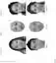 Fig. 13 - Normalization of facial images using deep neural networks
