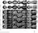 Fig. 15 - Normalization of facial images using deep neural networks