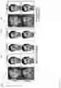 Fig. 17 - Normalization of facial images using deep neural networks