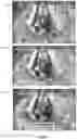 Fig. 11 - Methods and systems for crowd motion summarization via tracklet based human localization