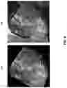 Fig. 07 - Methods and apparatus for training a classification model based on images of non-bagged produce or images of bagged produce generated by a generative model