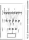 Fig. 17 - Systems, methods, and computer readable media for visualization of semantic information and inference of temporal signals indicating salient associations between life science entities