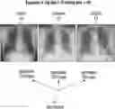 Fig. 01 - Unsupervised representation learning and active learning to improve data efficiency