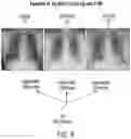 Fig. 13 - Unsupervised representation learning and active learning to improve data efficiency