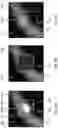 Fig. 04 - SYSTEMS AND METHODS FOR CALCIUM-FREE COMPUTED TOMOGRAPHY ANGIOGRAPHY