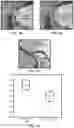 Fig. 07 - SYSTEMS AND METHODS FOR CALCIUM-FREE COMPUTED TOMOGRAPHY ANGIOGRAPHY