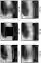 Fig. 08 - SYSTEMS AND METHODS FOR CALCIUM-FREE COMPUTED TOMOGRAPHY ANGIOGRAPHY