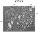 Fig. 06 - Method, device, and program for obtaining information from tissue sections for pathological diagnosis support