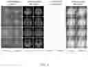 Fig. 10 - System and method to detect abnormality of subjects directly from MRI k-space data