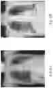 Fig. 09 - Method for assessing cardiothoracic ratio and cardiothoracic ratio assessment system