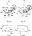 Fig. 15 - Auto segmentation using 2-D images taken during 3-D imaging spin