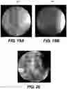Fig. 23 - Auto segmentation using 2-D images taken during 3-D imaging spin