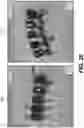 Fig. 30 - Auto segmentation using 2-D images taken during 3-D imaging spin