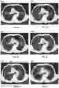 Fig. 10 - METHODS AND SYSTEMS FOR MEDICAL IMAGE SEGMENTATION