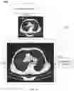 Fig. 14 - METHODS AND SYSTEMS FOR MEDICAL IMAGE SEGMENTATION