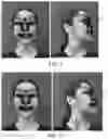 Fig. 09 - Method for acquiring texture of 3D model and related apparatus