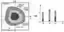 Fig. 01 - Method and system of quantitative intravascular optical coherence tomography