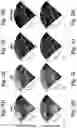 Fig. 13 - Real-time photoacoustic imaging using a precise forward model and fast iterative inverse