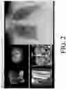 Fig. 03 - Method and system for rule based display of sets of images using image content derived parameters