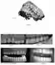 Fig. 03 - Method for analyzing a photo of a dental arch