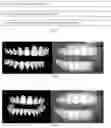 Fig. 05 - Method for analyzing a photo of a dental arch