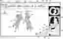 Fig. 01 - SYSTEM AND METHOD FOR ANNOTATION OF ANATOMICAL TREE STRUCTURES IN 3D IMAGES