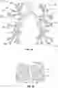 Fig. 02 - SYSTEM AND METHOD FOR ANNOTATION OF ANATOMICAL TREE STRUCTURES IN 3D IMAGES
