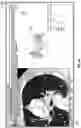 Fig. 31 - SYSTEM AND METHOD FOR ANNOTATION OF ANATOMICAL TREE STRUCTURES IN 3D IMAGES