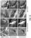 Fig. 20 - Self-supervised single-view 3D reconstruction via semantic consistency