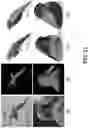 Fig. 22 - Self-supervised single-view 3D reconstruction via semantic consistency