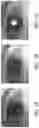 Fig. 03 - Compact system and method for iris recognition