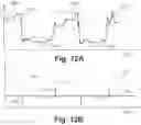 Fig. 07 - Personal system for the detection of a fall or a fall prone situation
