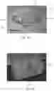 Fig. 07 - Multimodality anthropomorhic phantom apparatus
