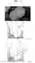 Fig. 21 - Signal processing device to improve contrast of a displayed image