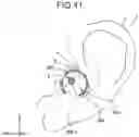Fig. 38 - Earphone device, headphone device, and method
