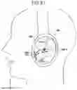 Fig. 58 - Earphone device, headphone device, and method