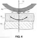 Fig. 05 - Restriction of suspension dimple contact point