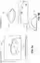 Fig. 06 - Restriction of suspension dimple contact point