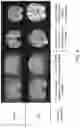 Fig. 11 - SYSTEMS AND METHODS FOR PROCESSING MRI DATA