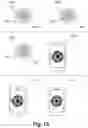 Fig. 10 - MACHINE LEARNING MODEL TO DETECT AND PREVENT PSYCHOLOGICAL EVENTS