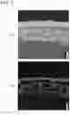 Fig. 05 - METHOD FOR MANUFACTURING THERMISTOR, AND THERMISTOR