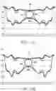 Fig. 16 - Profiled sputtering target and method of making the same