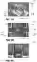 Fig. 04 - Perimeter trench formation and delineation etch delayering