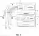 Fig. 02 - Cable detection using light sensor