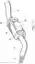 Fig. 22 - Compensating connector system