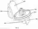 Fig. 06 - Apparatus and method for the conversion and enhancement of commercially available wireless electric hair clippers
