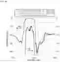 Fig. 16 - Acoustic wave filter and multiplexer